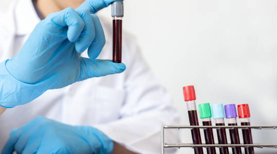 Philly Wellness Center's health assessment includes lab testing in Philadelphia with over 50 biomarkers to help create an anti-aging wellness plan.