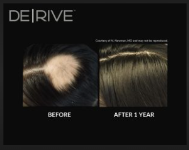Before and after image of DE|RIVE