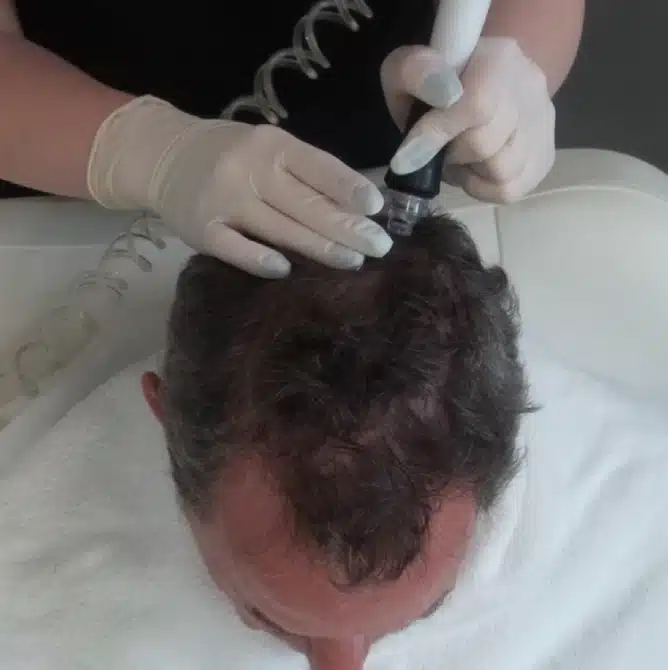 Personalized consultation at Philly Wellness Center to evaluate hair & scalp health before choosing a personalized treatment plan.