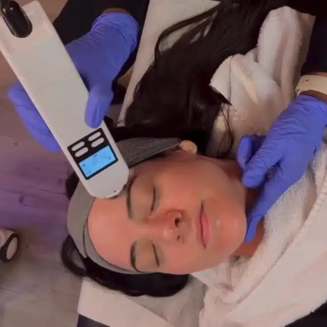 Philadelphia scalp facials like Aquafirme and Cellenis Derma PRP improve scalp health to help regrow hair naturally.