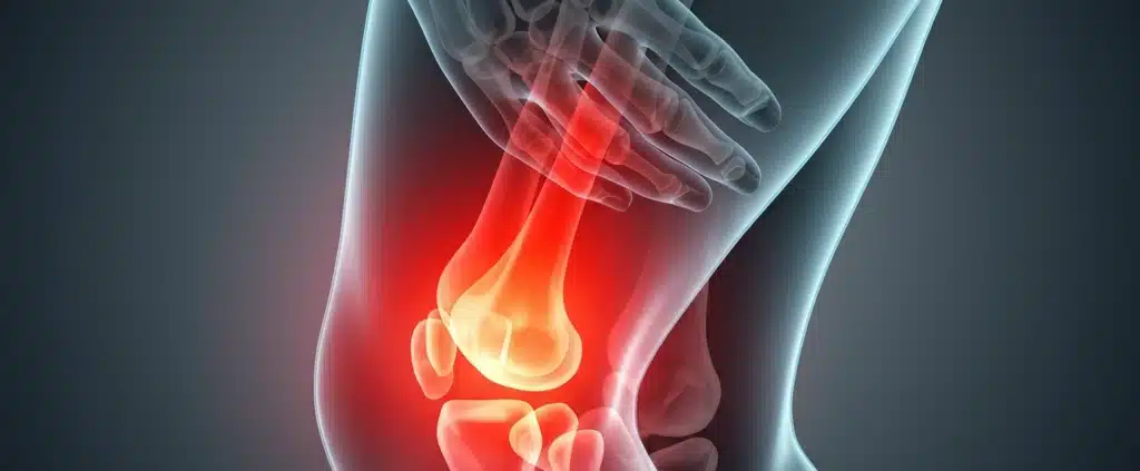Pain caused by arthritis. Therapy in Philadelphia with SoftWave may help patients find relief from arthritis symptoms.