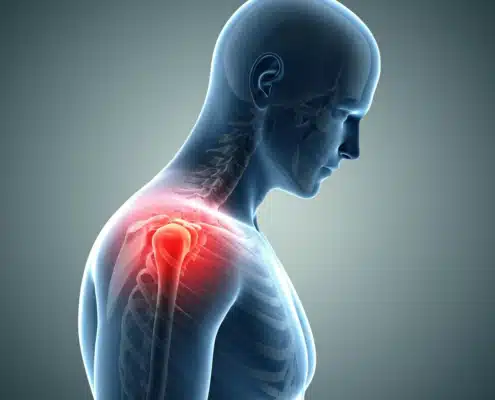 Chronic shoulder pain relief with SoftWave. Safe, fast, effective. Book your appointment now.