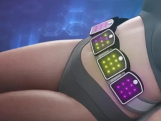 Philadelphia Nerveskin clinic, Philly Wellness Center helps patient tighten abdominal skin and remove cellulite with non-invasive cold cycling treatment. Call or book online to get started.