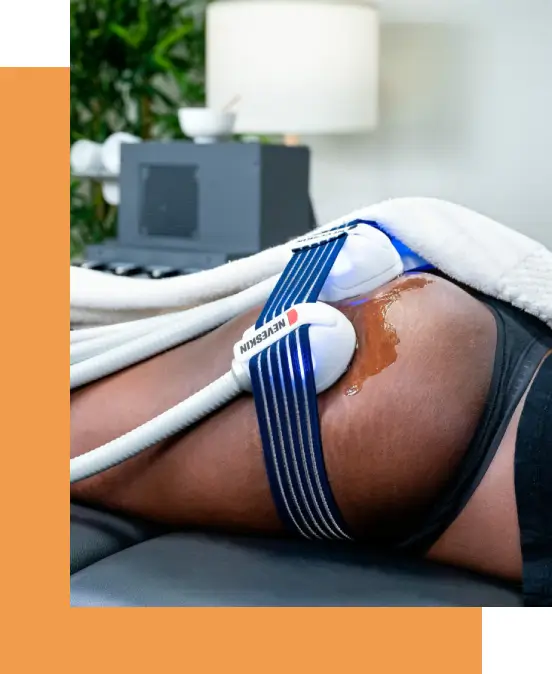 Philadelphia Nerveskin treatment at Philly Wellness Center. Reduce cellulite, lift saggy skin, ehance skin tone with the best clinic for Nerveskin treatment Philadelphia offers. Book online today.